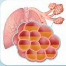 como se detecta la neumonia en ninos